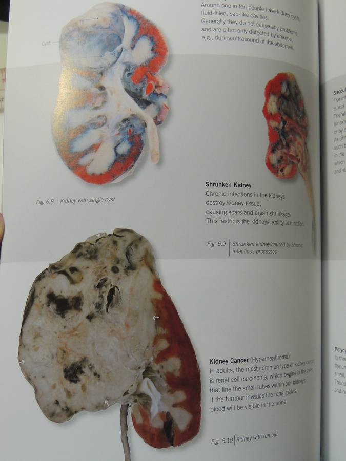 Body Worlds: The Original Exhibition - Gunther Von Hagen