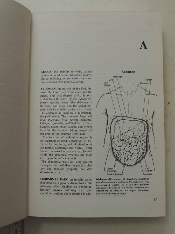 Fishbein's Medical and Health Encyclopedia  4 Volume Set, 1977