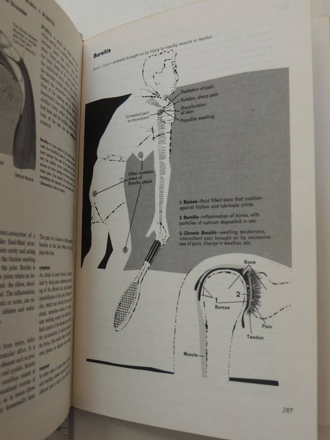 Fishbein's Medical and Health Encyclopedia  4 Volume Set, 1977