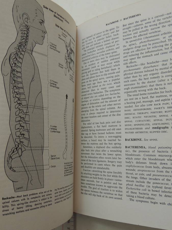 Fishbein's Medical and Health Encyclopedia  4 Volume Set, 1977