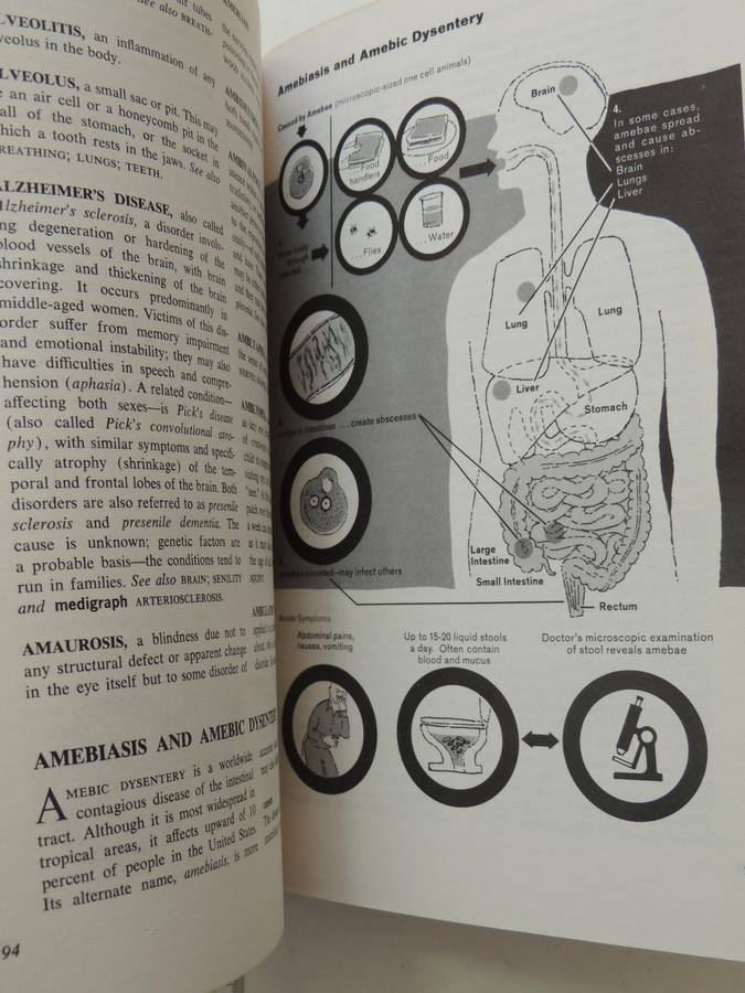 Fishbein's Medical and Health Encyclopedia  4 Volume Set, 1977