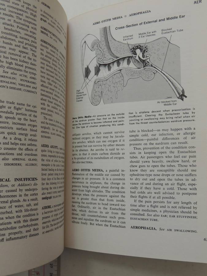 Fishbein's Medical and Health Encyclopedia  4 Volume Set, 1977