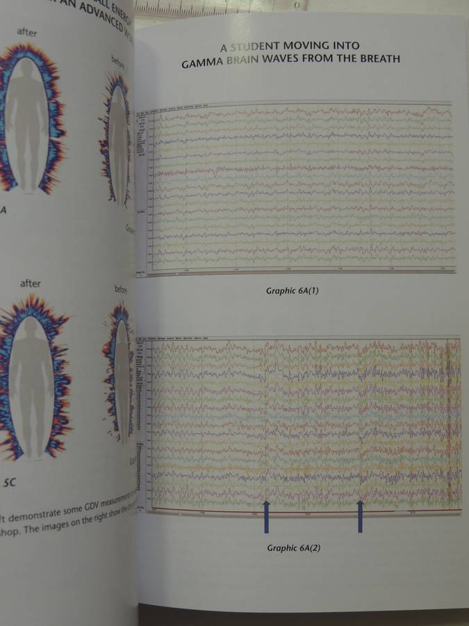 Becoming Supernatural - How Common People Are Doing the Uncommon- Joe Dispenza