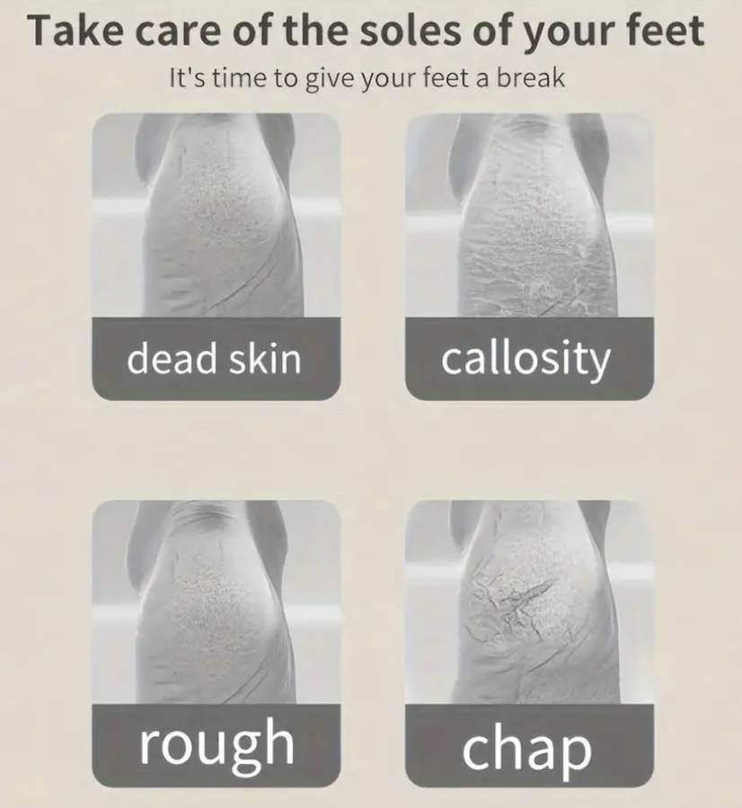 Wireless USB Charging Callus Remover