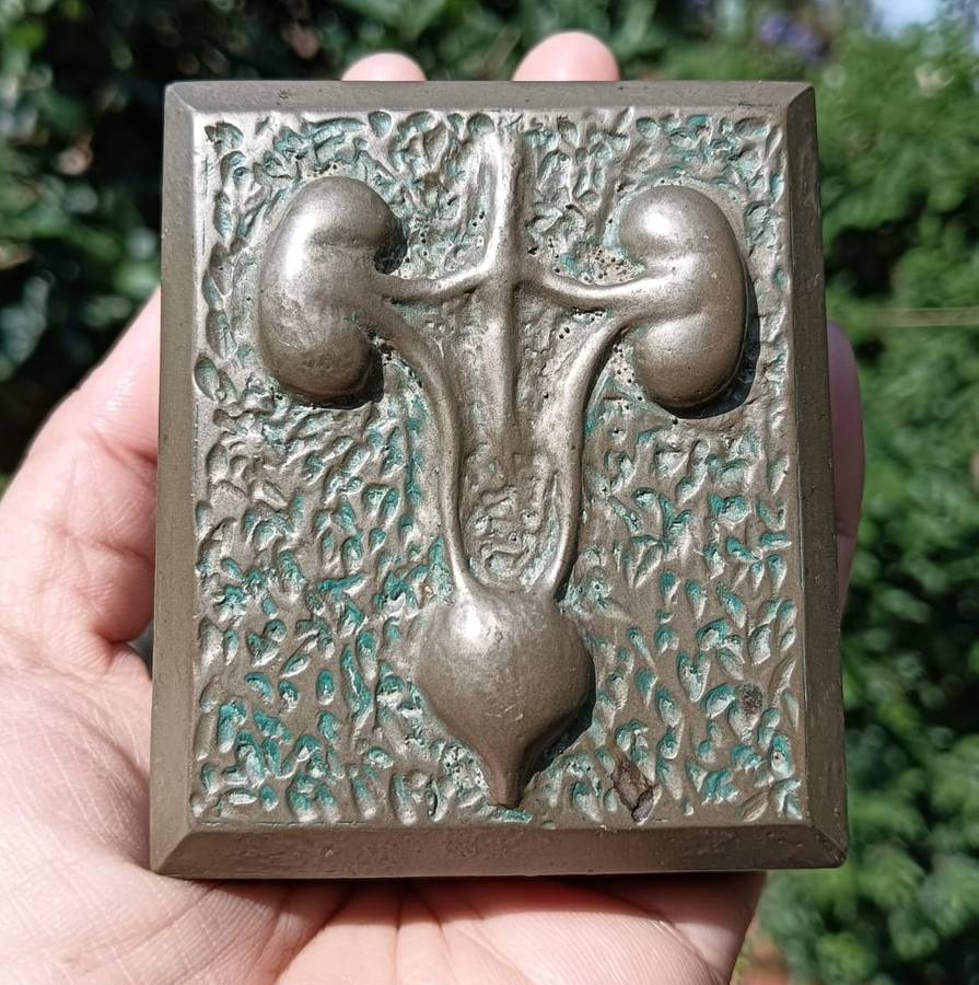 Five Medical Themed Paperweights: Lungs, Kidneys, Stomach, Femur, Hair