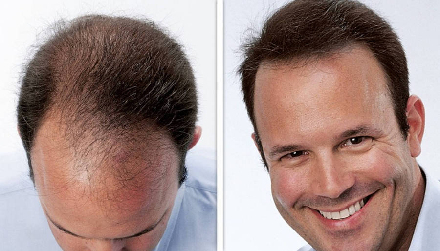 Dermmatch Hair Concealer
