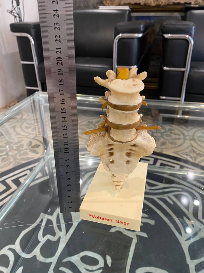 Rare Anatomical Lumbar Spine Model by Voltaren Geigy