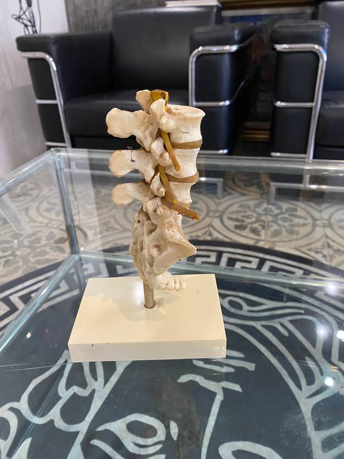 Rare Anatomical Lumbar Spine Model by Voltaren Geigy