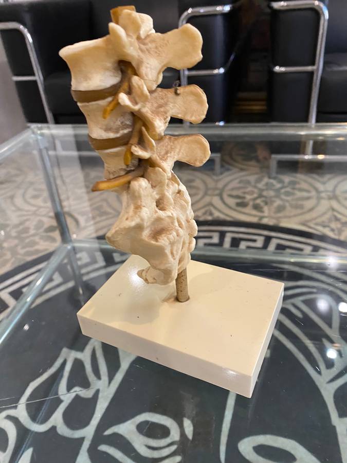 Rare Anatomical Lumbar Spine Model by Voltaren Geigy