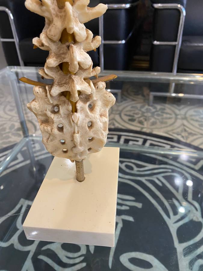 Rare Anatomical Lumbar Spine Model by Voltaren Geigy