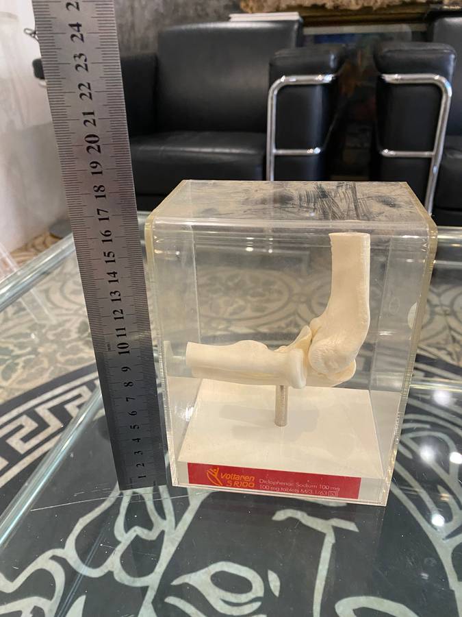 Human Elbow Joint Case