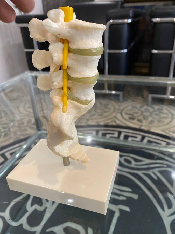 Voltaren Geigy Spine