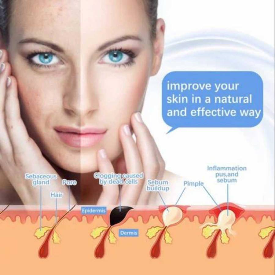 Portable High Frequency Machine For Acne Treatment Facial Wand