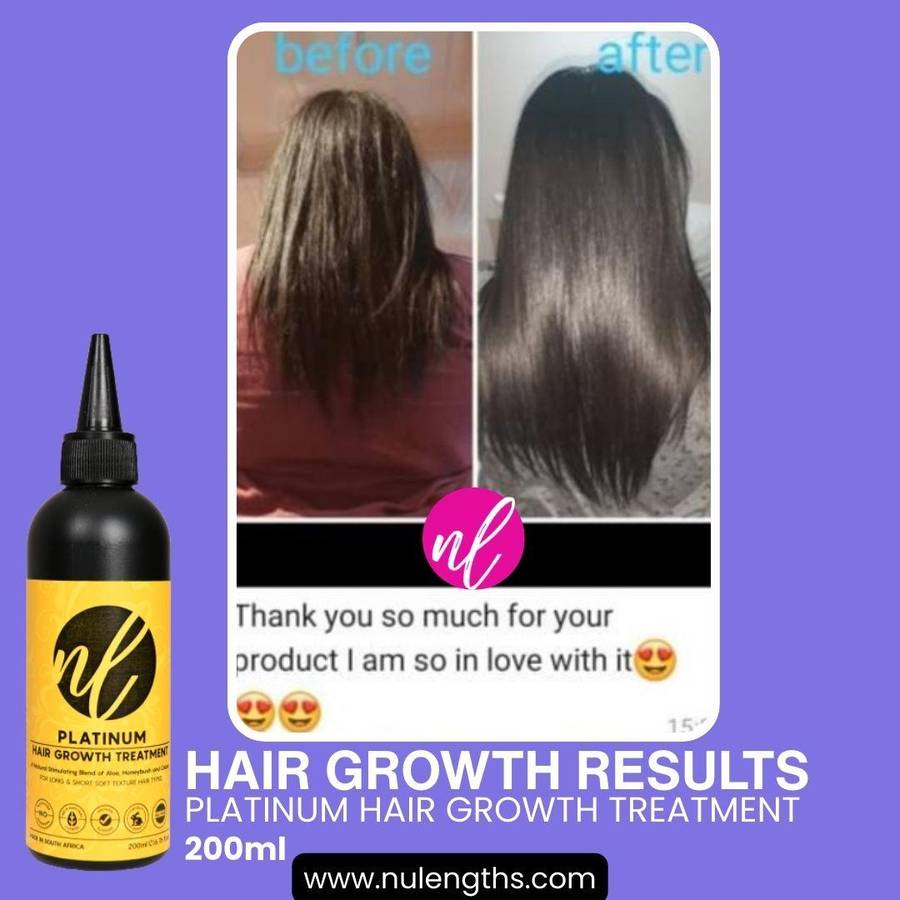Platinum Hair Growth Treatment 50ml