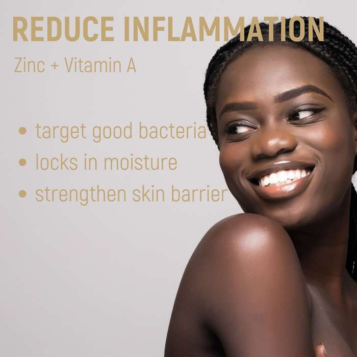 Acne.org.za Moisturise - luxurious moisturiser for Acne-prone skin