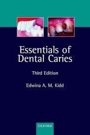 Essentials of Dental Caries - Edwina A. M. Kidd
