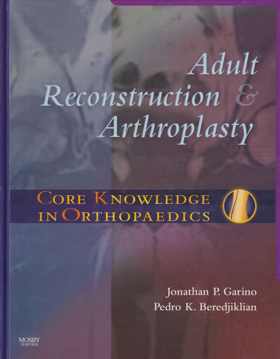 Core Knowledge in Orthopaedics: Adult Reconstruction and Arthroplast - Jonathan P. Garino