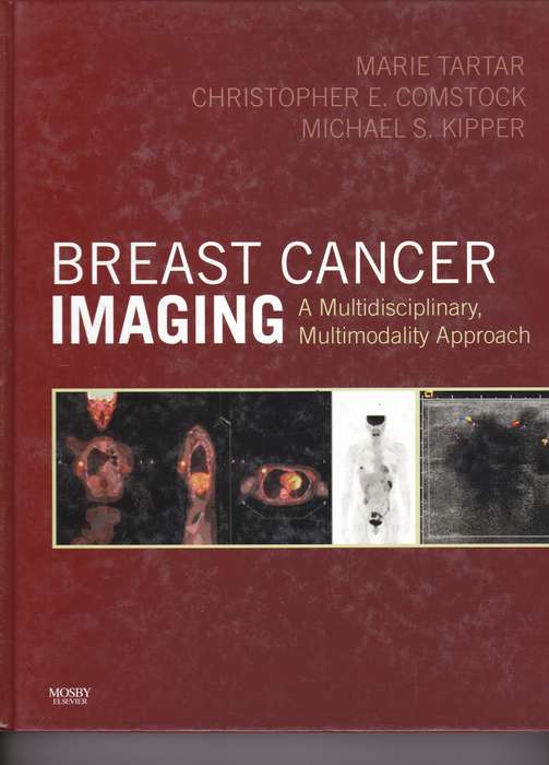 BREAST CANCER IMAGING SECONDHAND - TARTAR,M