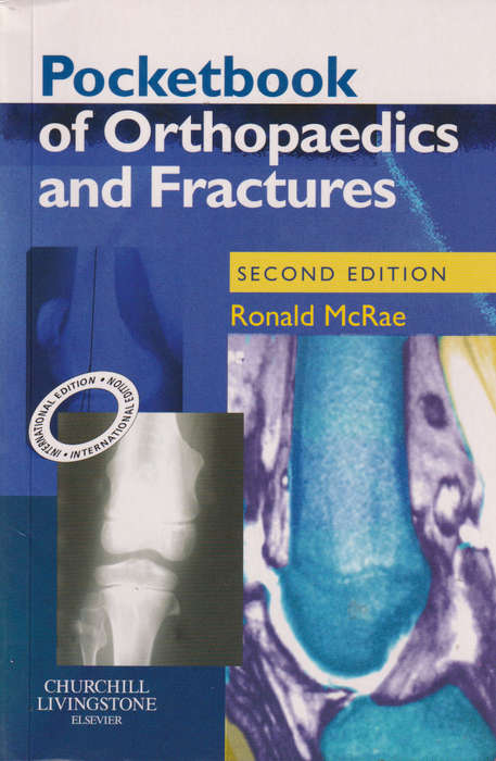 Pocketbook of Orthopaedics and Fractures International Edition - Ronald McRae