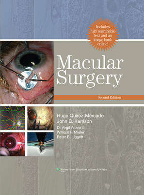 Macular Surgery - Hugo Quiroz-Mercado