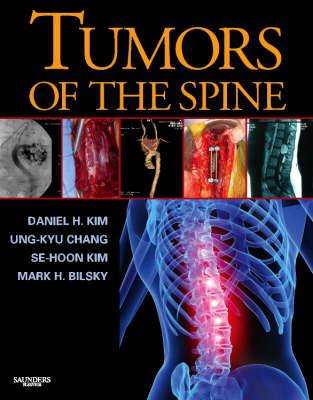 Tumors of the Spine - Daniel H. Kim
