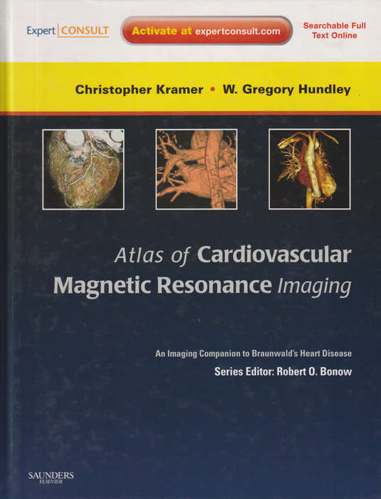 Atlas of Cardiovascular Magnetic Resonance Imaging: Expert Consult - - Christopher M. Kramer