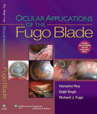 Ocular Applications of the Fugo Blade - ROY,H