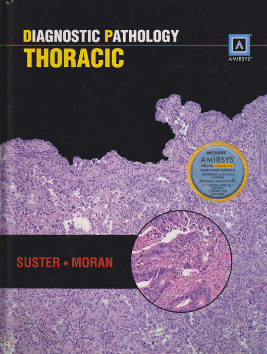 Diagnostic Pathology: Thoracic - Saul Suster