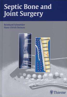 Septic Bone and Joint Surgery - Reinhard Schnettler
