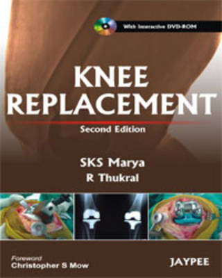 Knee Replacement - S. K. S. Marya