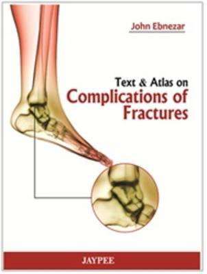 Text and Atlas of Complications of Fractures - John Ebnezar
