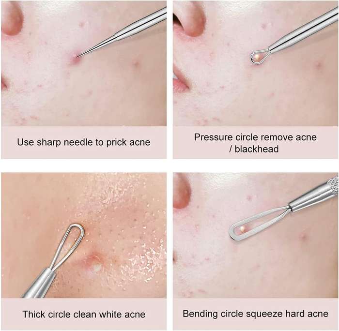 Beauty Tool Set - Pimple Popper Tool Kit - 4pcs
