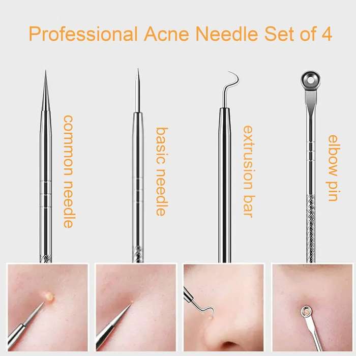 Beauty Tool Set - Pimple Popper Tool Kit - 4pcs
