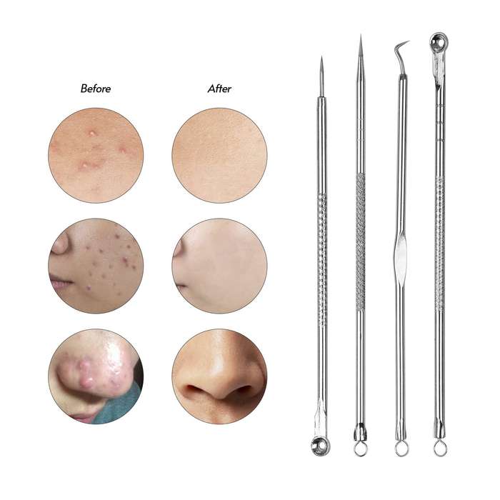 Beauty Tool Set - Pimple Popper Tool Kit - 4pcs