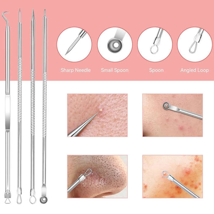 Beauty Tool Set - Pimple Popper Tool Kit - 4pcs