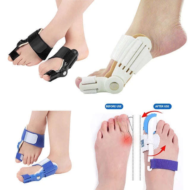 1PCS Hallux Valgus Correction Pedicure Device
