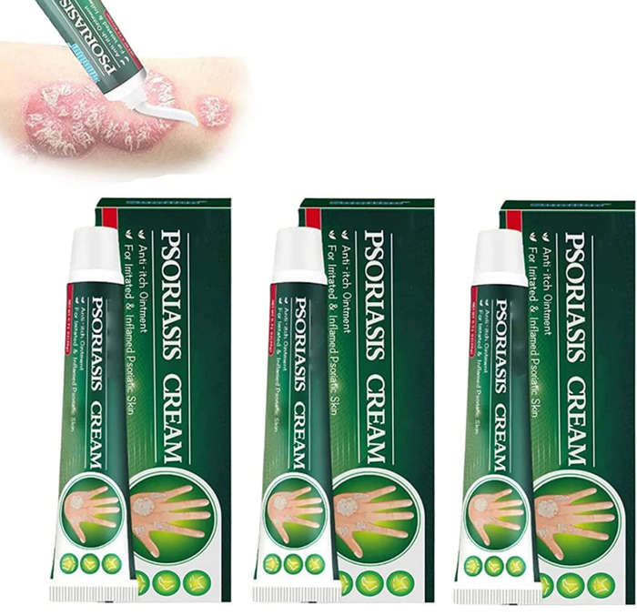 Skinmedix Psoriasis Cream, Zlimplify Psoriasis Cream, Psoriasis Control Face and Body Cream, Natu...