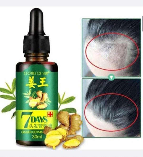 7 Day Ginger Hair Growth Oil