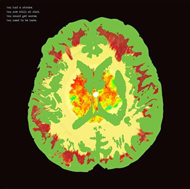 Minus 5 - Stroke Manor (CD)