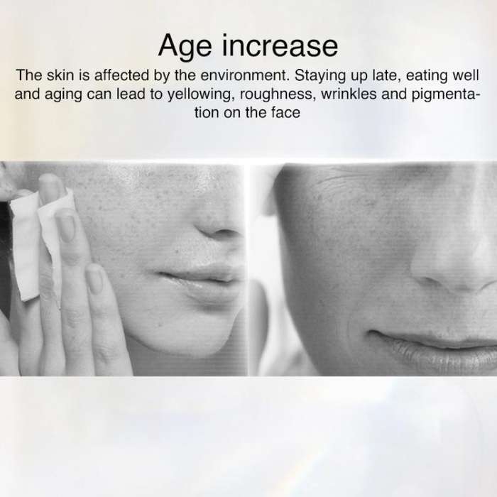 WG-M01 Milk Light Skin Rejuvenation Beauty Device Home Portable Photon Beauty Instrument, EU Plug...