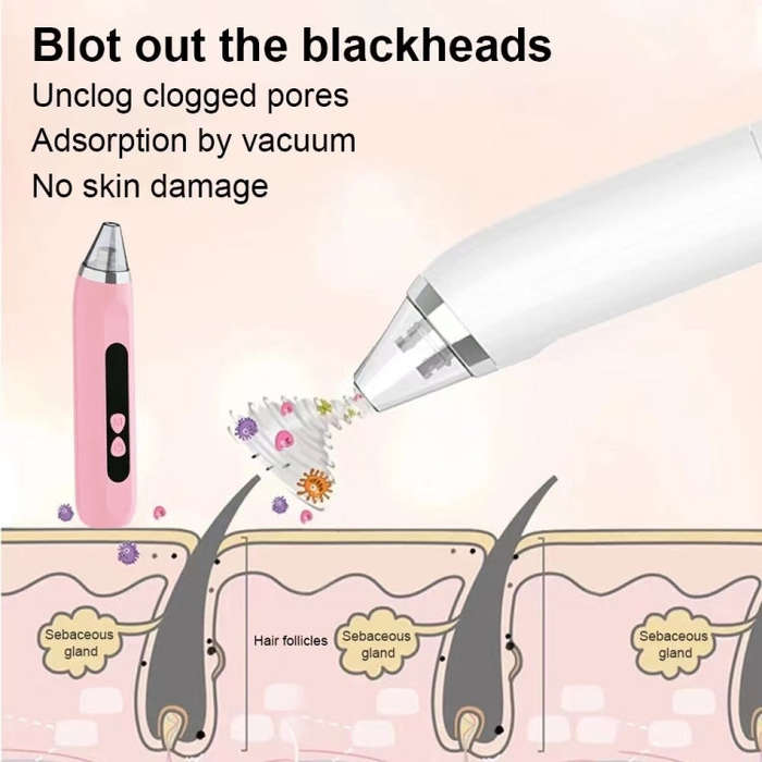 Blackhead Remover Vacuum Pore Cleaner Facial Deep Cleaning Beauty Tools, Dry Battery(White), Dry ...