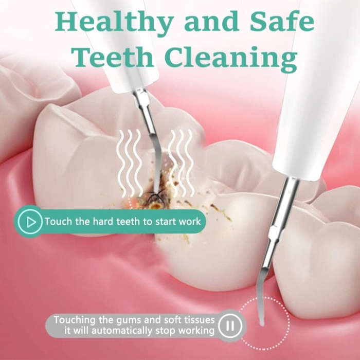Ultrasonic Electric Dental Scaler Teeth Plaque Cleaner Dental Stone Removal With LED Light, Packa...