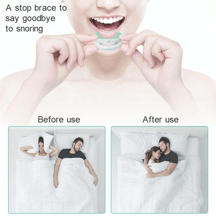 Yuknight Adult Home Throat Anti-snoring Mouthguard Device