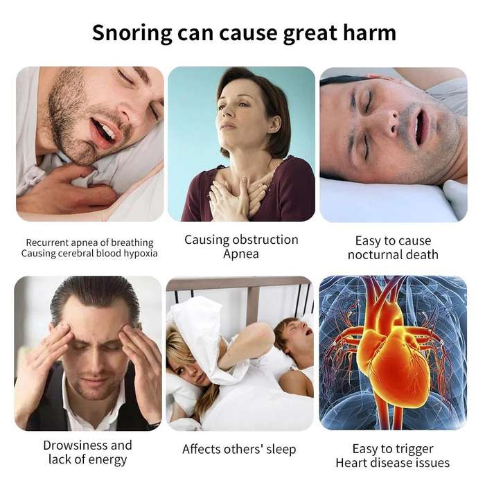 Smart Anti-snoring Device TENS Double Pulse Sound Wave Induction Sleep Snoring Breathing Correcto...