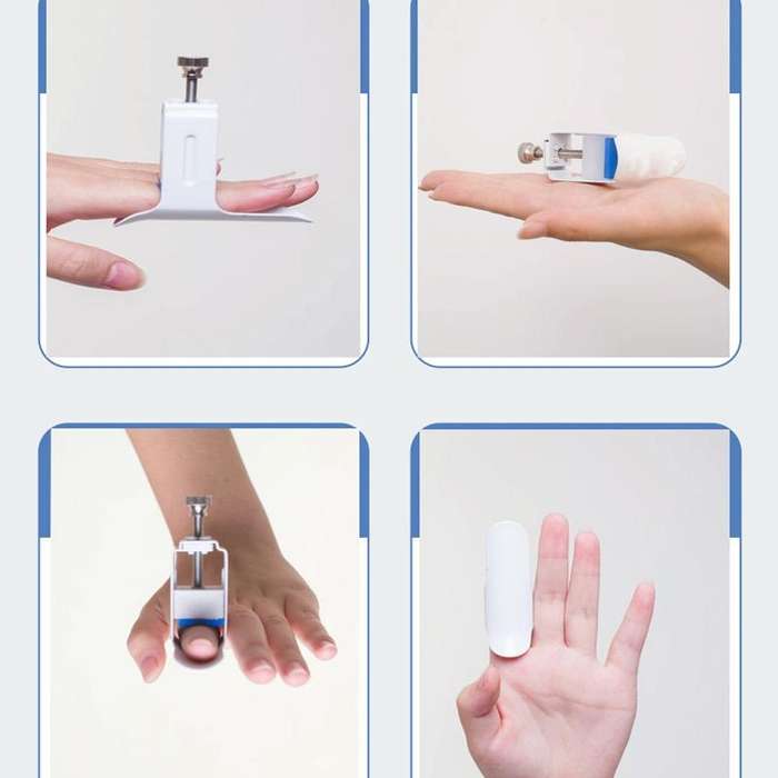 Finger Straightener Finger Fixing Splint Knuckle Bending Rehabilitation Straightening Corrector, ...