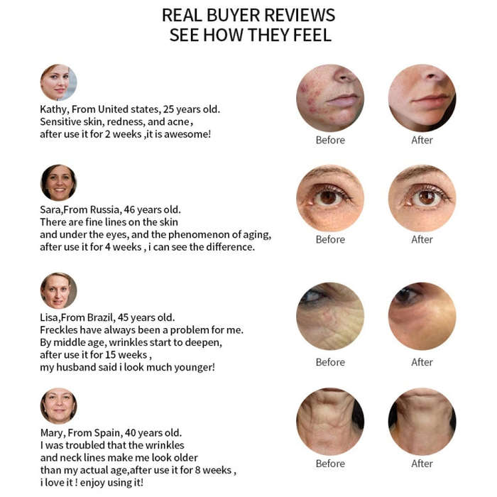 Radio Mesotherapy Electroporation Face Beauty Pen Radio Frequency LED Photon Face Skin Rejuvenati...