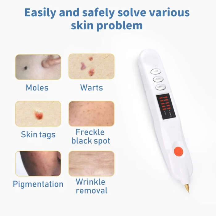 Spot Mole Pen Spot Removal Instrument Home Beauty Instrument, Spec: US  Plug -in Model(White)