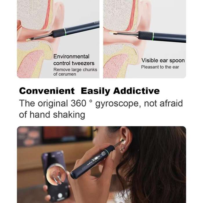 Bebird Note5 Pro Visual Ear Scoop Ear Picking Tool Cleaning Set(Sky Blue)