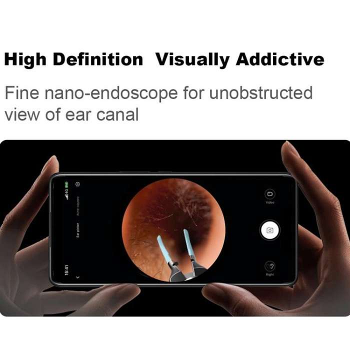 Bebird Note5 Pro Visual Ear Scoop Ear Picking Tool Cleaning Set(Sky Blue)