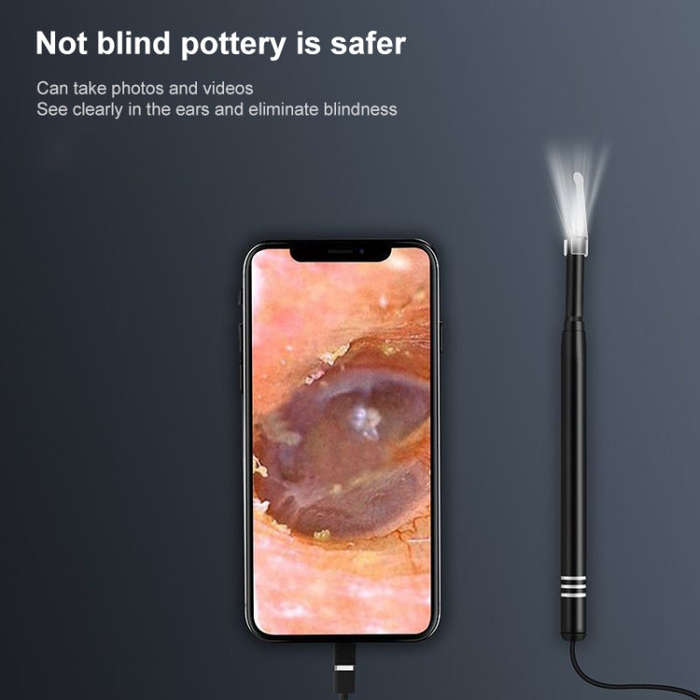 AN108 3 in 1 Smart HD 5.5mm Lens Visual Earpick Not Compatible With Some Phones (Random Color)
